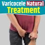 The best treatment for varicocele treatment without surgery 