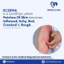 Heal Eczema with Expert Care: Bindal Clinic's Specialized