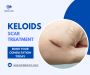 Effective Keloids Treatment at Bindal Clinic