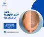 Restore Your Confidence with Hair Transplant Treatment