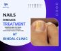 Revitalize Your Nails: Expert Treatment for Nail Diseases