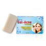 Best Acne Soap in India