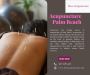 Discover the Benefits of Acupuncture in Palm Beach