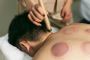 Revitalize Your Body with Acupuncture Massage in Bay Ridge!