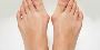 What are measures to remove toe bunion