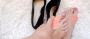7 ways to treat toe bunion without surgery