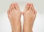 3 Bunion Prevention and Treatment 