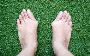 5 Quicker recovery tips for keyhole bunion surgery 