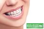 Easy and secure straighten teeth with us