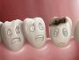 5 measures of dental implants procedure