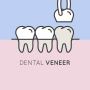 Dental crown price Singapore | 5 benefits of Dental crown