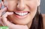 7 Ultimate points guide teeth whitening price Singapore 