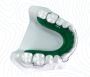 Get the Best Hawley Retainers from China Orthodontic Lab