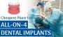 Dental Implants in the Most Affordable Country