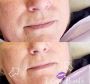 Best Aesthetic Clinic in Bodicote Best Aesthetic Clinic in Bodicote
