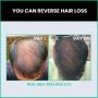 Regrow Your Hair in 60 Days with This Hair Growth Serum