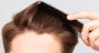 Hair Loss Restoration Experts' Top Guide of Hair Types