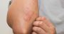 Common Skin Irritants from Skin Care Experts Australia
