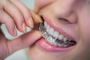 Porcelain Veneers: Enhancing Your Smile's Beauty