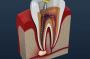 Root Canal Specialist Near Me | Root Canal Treatment Procedu