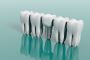 Dental implants - Newcastle dental