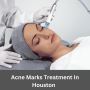 Acne Marks Treatment In Houston