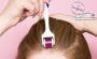 Microneedling gegen Haarausfall mit Dermaroller