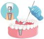 Dental Implants: Restoring Smiles with Confidence