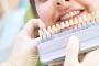 The Price of a Radiant Smile: Exploring Veneers Cost