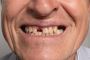 Revive Your Smile with Missing Tooth Replacement