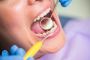 Restoring Your Full Mouth: Boosting Your Smile & Oral Health