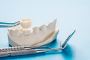 What Exactly Is a Dental Bridges?