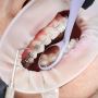 New Orleans Orthodontist: Smile Transformation Experts Await