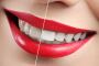 Confident Smile With Teeth Whitening Service in South Dakota