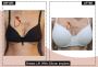 Female Breast Reduction Surgery In India