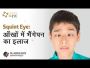 Squint Eye : आँखों मे भैंगेपन का इलाज | What causes it?