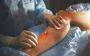 Precision Healing: Varicose Vein Laser Treatment in Mumbai w