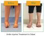 Ankle Injuries Treatment in Dubai