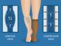 A Complete Guide To Compression Treatment For Varicose Veins