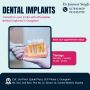 Discover the Best Dental Implants in Gurgaon for a Smile