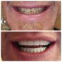 Transform Your Smile with Dentist Sacramento's Expertise!