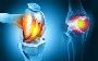 Joint Replacement Surgeon in indore