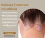 Psoriasis Treatment In Ludhiana by Dr. Shikha Aggarwal