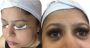 permanent eyelash extension in Durgapur