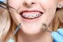 Transform Your Smile with In-Braces Treatment in Richmond