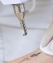 Need The Best Tattoo Removal Services in Surry Hills