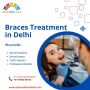 Braces Treatment in Delhi | Epione Dental Clinic