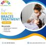 Dental Braces Treatment in Indirapuram | Epione Dental Clini