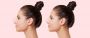 Get perfect shapes Nose Rhinoplasty Surgery In Delhi