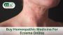 Choose the Most Effective Homeopathic Medicine For Eczema